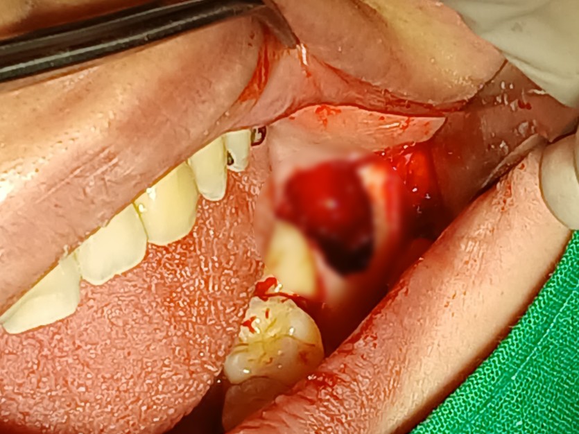 173322_dea1574c25.jpg