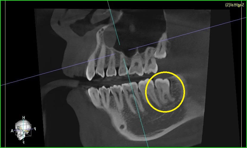 image slot