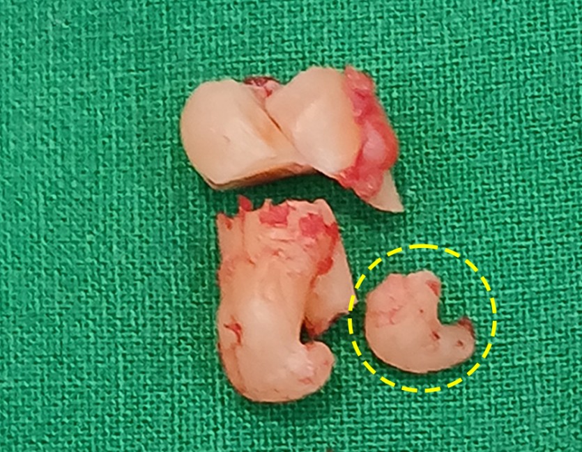 image slot