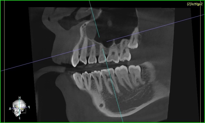 image slot